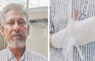 বরিশালে চাঁদা না দেওয়ায় আ.লীগ নেতাকে পিটিয়ে হাত ভেঙে দিল বিএনপি নেতারা!