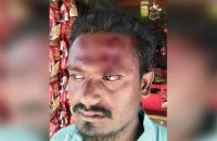 বরিশালে তুচ্ছ ঘটনায় ঠিকাদারকে কুপিয়ে টাকা ছিনতাই