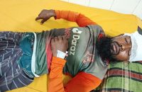 হিজলায় তুচ্ছ ঘটনায় শ্রমিকের মাথা পিটিয়ে গুরুতর আহত