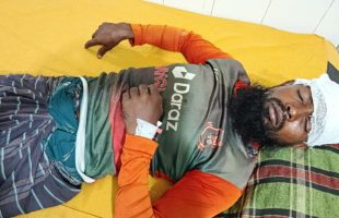 হিজলায় তুচ্ছ ঘটনায় শ্রমিকের মাথা পিটিয়ে গুরুতর আহত