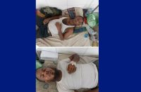 বাকেরগঞ্জে জমি বিরোধে দু’দফা হামলায় আহত ২ , শেবাচিমে ভর্তি !