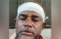 বরিশালে অবৈধ স্থাপনা উচ্ছেদের জেরে বিএনপি নেতাকে কুপিয়ে জখম