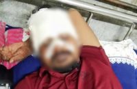 বরিশাল জেলা ছাত্রদলের যুগ্ন সম্পাদককে পিটিয়ে ও কুপিয়ে জখম