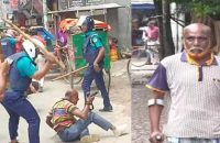 জুলাই আন্দোলনে পুলিশের লাঠিচার্জের পর এখনো সোজা হয়ে দাঁড়াতে পারেননি সাংবাদিক শামীম!