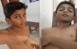 বরিশালে বলৎকারের কথা বলে দেয়ায় মাদ্রাসাছাত্রকে বেধম পেটালেন শিক্ষক!