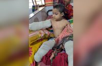 অপচিকিৎসায় হাত-পা হারানো শিশু তানভীর অবশেষে মারা গেল