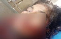 বরিশালে আল্লাহু আকবর বলে হত্যার উদ্দেশ্যে আপন চাচিকে কুপিয়ে জখম