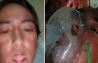 বরিশালে ভুল চিকিৎসায় জীবন-মৃ’ত্যুর সন্ধিক্ষণে বিএম কলেজছাত্রী!