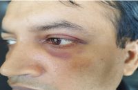 বরগুনায় চাঁদা না পেয়ে স্কুল শিক্ষককে অপহরণ, মধ্যযুগীয় নির্যাতন