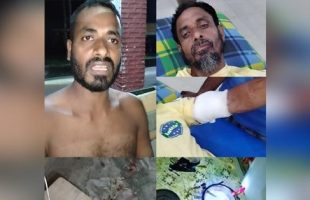 বরগুনায় ছাগলে গাছ খাওয়া নিয়ে দুই পরিবারের সংঘর্ষ, নারীসহ আহত ৩