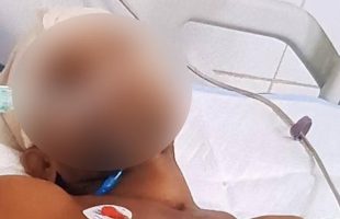 বরিশালে তুচ্ছ ঘটনায় হামলার শিকার ট্রলি চালকের মৃত্যু