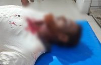 ব্যবসায়ীকে হাতুড়িপেটা করে টাকা ছিনতাইয়ের অভিযোগ