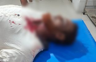 ব্যবসায়ীকে হাতুড়িপেটা করে টাকা ছিনতাইয়ের অভিযোগ