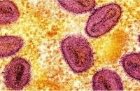 আফ্রিকায় নতুন ভাইরাস মারবুর্গের প্রাদুর্ভাব, আক্রান্ত ৯