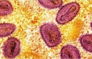 আফ্রিকায় নতুন ভাইরাস মারবুর্গের প্রাদুর্ভাব, আক্রান্ত ৯