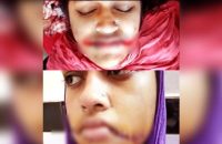 বরিশালে বখাটের কাস্তের আঘাতে কলেজছাত্রীর মুখমন্ডল ক্ষত বিক্ষত