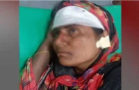 দাঁড়িপাল্লার প্রচারে বাধা, নারীর কান ছিঁড়ে মাথা ফাটালেন যুবদল নেতা