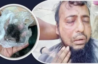 জামায়াত কর্মীকে পিটিয়ে দাড়ি ছিড়ে ফেললেন বিএনপি কর্মীরা