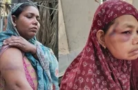 ঝালকাঠিতে দাঁড়িপাল্লায় ভোট দেওয়ায় তিন নারীকে পিটিয়ে আহত