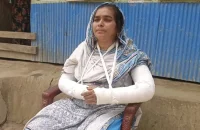 খাস জমি দখলকে কেন্দ্র করে হামলা: নারীর দুই হাত ভাঙার অভিযোগ