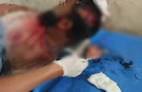 মহিপুরে মাদক সেবনে বাধা: যুবককে প্রকাশ্যে কুপিয়ে হত্যাচেষ্টা