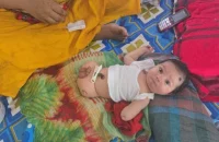 পিরোজপুরে হাত-পাবিহীন শিশুর জন্ম: বাবা বললেন ফেলে দিতে