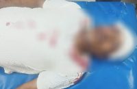 বরিশালে বিএনপি নেতাকে কুপিয়ে জখম