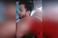 বরিশালে কুপিয়ে কলেজছাত্রের হাত বিচ্ছিন্ন, আসামীদের বাঁচাতে এবার ধর্ষণচেষ্টা মামলা