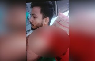 বরিশালে কুপিয়ে কলেজছাত্রের হাত বিচ্ছিন্ন, আসামীদের বাঁচাতে এবার ধর্ষণচেষ্টা মামলা