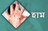 বরিশাল শেবাচিম হাসপাতালে হামের উপসর্গে আরও এক শিশুর মৃত্যু
