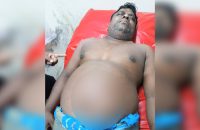 বরিশালে মাদকের প্রতিবাদ করায় ব্যবসায়ীকে ছুরিকাঘাত