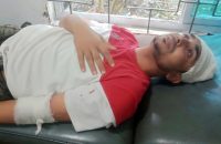 মনপুরায় শিক্ষক ও তাঁর ভাইকে মারধরের অভিযোগ জামায়াত নেতার বিরুদ্ধে