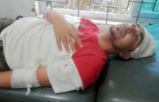 মনপুরায় শিক্ষক ও তাঁর ভাইকে মারধরের অভিযোগ জামায়াত নেতার বিরুদ্ধে