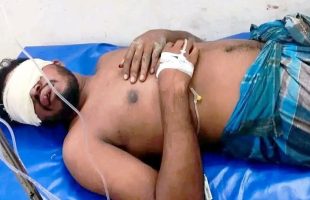 মাইক্রোবাসে তুলে যুবককে নির্যাতন, চোখ উপড়ে ফেলার অভিযোগ